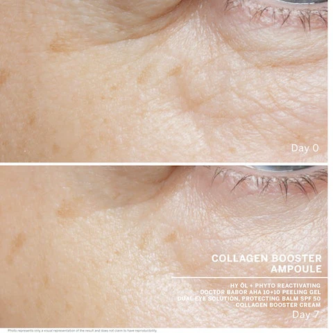 BABOR_Collagen_Booster_Ampoule_Before_After_720x (1)